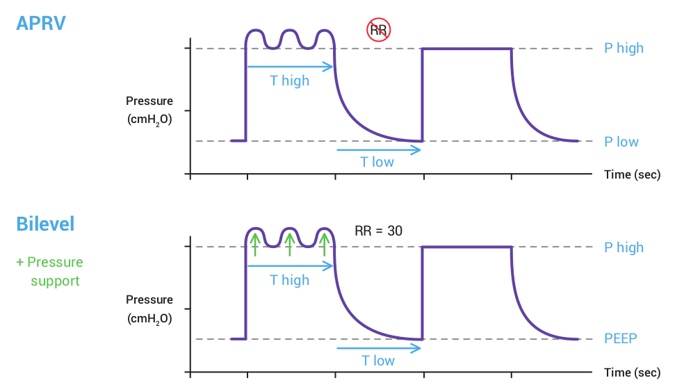 APRV and bilevel